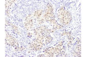 Immunohistochemistry (IHC) image for anti-Proteasome (Prosome, Macropain) Subunit, beta Type, 5 (PSMB5) (AA 213-263) antibody (ABIN7453445)