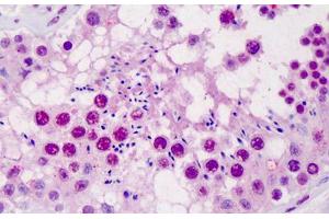 Human Testis: Formalin-Fixed, Paraffin-Embedded (FFPE) (SCML1 Antikörper  (AA 3-101))