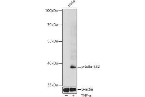 Western blot analysis of extracts of HeLa cells, using Phospho-IκBα-S32 antibody (ABIN6135267, ABIN6136154, ABIN6136155 and ABIN6225645) at 1:1000 dilution. (NFKBIA Antikörper  (pSer32))