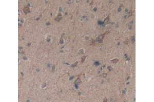 Used in DAB staining on fromalin fixed paraffin- embedded Kidney tissue (Basonuclin 1 Antikörper  (AA 43-246))