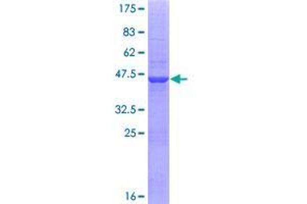 Zinc Finger Protein 44 Protein (ZNF44) (AA 1-154) (GST tag)