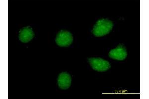 Immunofluorescence of purified MaxPab antibody to CREB3L1 on HeLa cell. (CREB3L1 Antikörper  (AA 1-519))