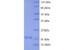 SDS-PAGE (SDS) image for Bone Morphogenetic Protein 6 (BMP6) (AA 382-513), (partial) protein (His tag) (ABIN5712750)