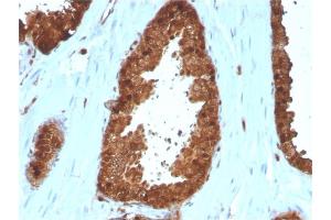 Immunohistochemistry (IHC) image for anti-Annexin A1 (ANXA1) antibody (ABIN6939608)