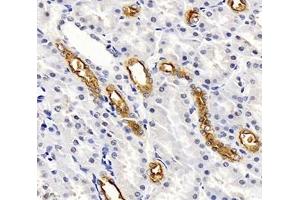 Immunohistochemistry (Paraffin-embedded Sections) (IHC (p)) image for anti-Solute Carrier Family 12 (Sodium/potassium/chloride Transporters), Member 1 (SLC12A1) antibody (ABIN7075651)