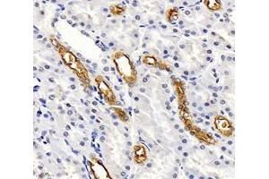 Immunohistochemistry analysis of paraffin-embedded rat kidney using,SLC12A1 (ABIN7075651) at dilution of 1: 2000 (SLC12A1 Antikörper)