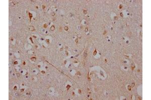 IHC image of ABIN7127325 diluted at 1:100 and staining in paraffin-embedded human brain tissue performed on a Leica BondTM system. (Rekombinanter ADORA1 Antikörper)