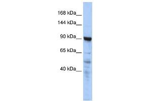 WB Suggested Anti-CTAGE5 Antibody Titration:  0. (MIA2 Antikörper  (N-Term))