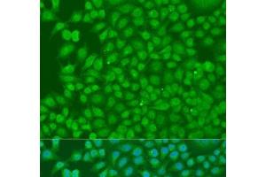 Immunofluorescence analysis of U2OS cells using BIRC3 Polyclonal Antibody at dilution of 1:100. (BIRC3 Antikörper)