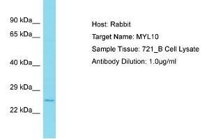 Host: Rabbit Target Name: MYL10 Sample Type: 721_B Whole Cell lysates Antibody Dilution: 1. (MYL10 Antikörper  (N-Term))