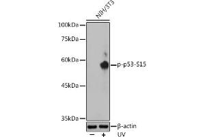 Western blot analysis of extracts of NIH/3T3 cells, using Phospho-p53-S15 antibody ( ABIN3023600, ABIN3023601, ABIN3023602 and ABIN6225458) at 1:500 dilution. (p53 Antikörper  (pSer15))