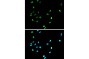Immunofluorescence analysis of A549 cells using RUNX1 antibody. (RUNX1 Antikörper)