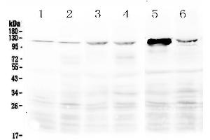 Western blot analysis of DDX58 using anti-DDX58 antibody . (DDX58 Antikörper  (AA 871-925))