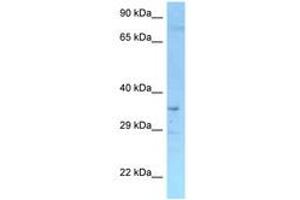 Image no. 1 for anti-Ring Finger and FYVE-Like Domain Containing 1 (RFFL) (N-Term) antibody (ABIN6748259) (RFFL Antikörper  (N-Term))