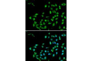 Immunofluorescence analysis of U2OS cells using CTNNBL1 antibody . (CTNNBL1 Antikörper  (AA 264-563))