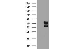 Western Blotting (WB) image for anti-Prenyl (Decaprenyl) Diphosphate Synthase, Subunit 2 (PDSS2) antibody (ABIN1500136) (PDSS2 Antikörper)