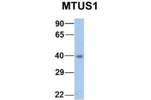 Western Blotting (WB) image for anti-Microtubule Associated Tumor Suppressor 1 (MTUS1) (Middle Region) antibody (ABIN2781855)