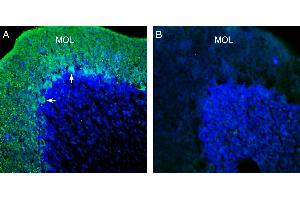 Expression of KCNT1 (Slack) in rat cerebellum. (Potassium Channel, Subfamily T, Member 1 (KCNT1) Peptid)