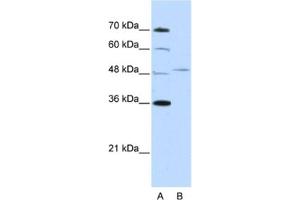 Western Blotting (WB) image for anti-Forkhead Box Q1 (FOXQ1) antibody (ABIN2461966) (FOXQ1 Antikörper)
