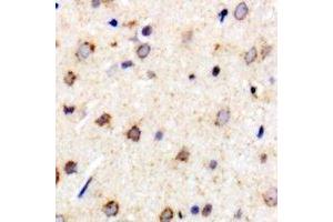 Immunohistochemical analysis of Metaxin-1 staining in rat brain formalin fixed paraffin embedded tissue section. (Metaxin 1 Antikörper)