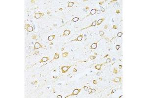 Immunohistochemistry of paraffin-embedded rat brain using HSPA5 antibody.