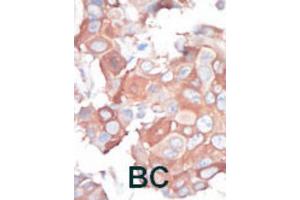 Immunohistochemistry (IHC) image for anti-Mitogen-Activated Protein Kinase Kinase Kinase 1 (MAP3K1) antibody (ABIN3003567) (MAP3K1 Antikörper)