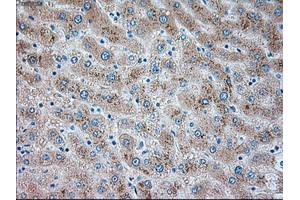 Immunohistochemistry (IHC) image for anti-Transient Receptor Potential Cation Channel, Subfamily M, Member 4 (TRPM4) antibody (ABIN1501531) (TRPM4 Antikörper)