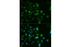 Immunofluorescence analysis of MCF-7 cells using TLR8 antibody (ABIN5970696). (TLR8 Antikörper)