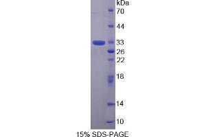 Image no. 1 for Torsin Family 1, Member B (Torsin B) (TOR1B) (AA 83-327) protein (His tag) (ABIN4990585)