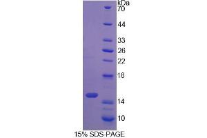Image no. 1 for S100 Calcium Binding Protein A9 (S100A9) (AA 12-89) protein (His tag) (ABIN6236787) (S100A9 Protein (AA 12-89) (His tag))