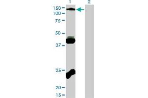 Western Blotting (WB) image for anti-EPH Receptor B3 (EPHB3) (AA 899-998) antibody (ABIN598667) (EPH Receptor B3 Antikörper  (AA 899-998))