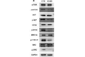 Human KBTBD8 regulated the activity of multiple cell cycle kinases in EOC cells. (MTOR Antikörper  (pSer2448))