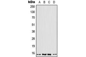 Western blot analysis of Profilin 2 expression in A431 (A), H1299 (B), mouse brain (C), rat skeletal muscle (D) whole cell lysates.