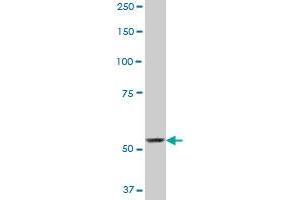 SP110 monoclonal antibody (M01), clone 8C8.