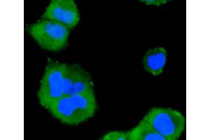 Immunofluorescence analysis of HeLa cells using MAPK14 antibody (ABIN5997045). (MAPK14 Antikörper)