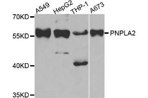 Western Blotting (WB) image for anti-Patatin-Like phospholipase Domain Containing 2 (PNPLA2) antibody (ABIN1882372) (PNPLA2 Antikörper)