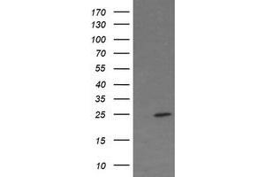Image no. 3 for anti-Fetal and Adult Testis Expressed 1 (FATE1) antibody (ABIN1498225) (FATE1 Antikörper)