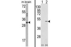 Image no. 1 for anti-Capping Protein (Actin Filament) Muscle Z-Line, beta (CAPZB) (C-Term) antibody (ABIN452808) (CAPZB Antikörper  (C-Term))