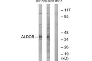 Western blot analysis of extracts from MCF-7/HuvEc cells, using ALDOB Antibody. (ALDOB Antikörper  (AA 111-160))