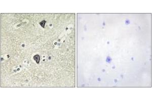 Immunohistochemistry analysis of paraffin-embedded human brain tissue, using FGFR3 Antibody. (FGFR3 Antikörper  (AA 131-180))