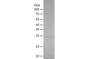 Western Blotting (WB) image for Interleukin 6 (IL6) (AA 21-207) protein (His tag) (ABIN7123605) (IL-6 Protein (AA 21-207) (His tag))