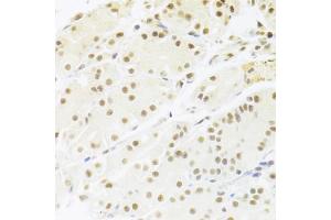 Immunohistochemistry of paraffin-embedded human stomach using RBPJ Antibody (ABIN1876876) at dilution of 1:100 (40x lens). (RBPJ Antikörper)