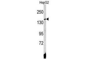Image no. 1 for anti-ATPase, Cu++ Transporting, beta Polypeptide (ATP7B) (C-Term) antibody (ABIN452773) (ATP7B Antikörper  (C-Term))