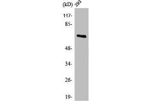 Western Blot analysis of 293 cells using POTE14/22 Polyclonal Antibody (POTEG/POTEH/POTEM (C-Term) Antikörper)