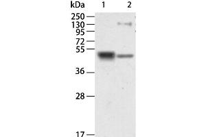 Western Blot analysis of Human kidney and Mouse brain tissue using RAGE Polyclonal Antibody at dilution of 1:750 (RAGE Antikörper)