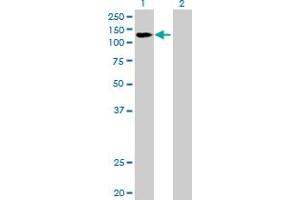 Western Blot analysis of DDX42 expression in transfected 293T cell line by DDX42 MaxPab polyclonal antibody. (DDX42 Antikörper  (AA 1-819))