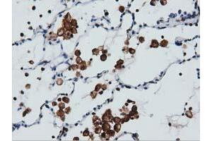 Immunohistochemical staining of paraffin-embedded Human colon tissue using anti-ARHGAP25 mouse monoclonal antibody. (ARHGAP25 Antikörper)