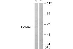 Immunohistochemistry analysis of paraffin-embedded human braIin tissue using DRP-2 (Ab-514) antibody. (DRP2 Antikörper  (Thr514))