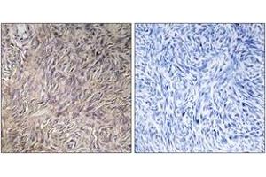Immunohistochemistry analysis of paraffin-embedded human ovary tissue, using FGF22 Antibody. (FGF22 Antikörper  (AA 71-120))