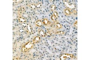 Immunohistochemistry of paraffin embedded mouse kidney using LOXL4 (ABIN7074541) at dilution of 1:400 (400x lens) (LOXL4 Antikörper)